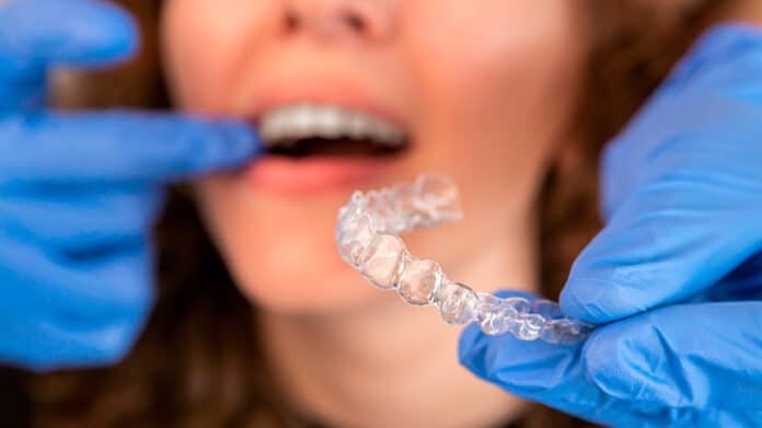 Invisalign no lo aguanto trucos